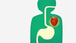 Poster for Why Diets Fail