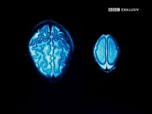 Poster for Brain Magic