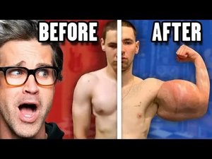 Poster for Reacting To Extreme Before And After Photos