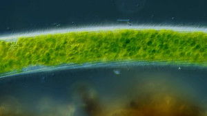 Poster for We Found a Super Rare Microbe!