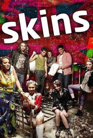 Skins-スキンズ